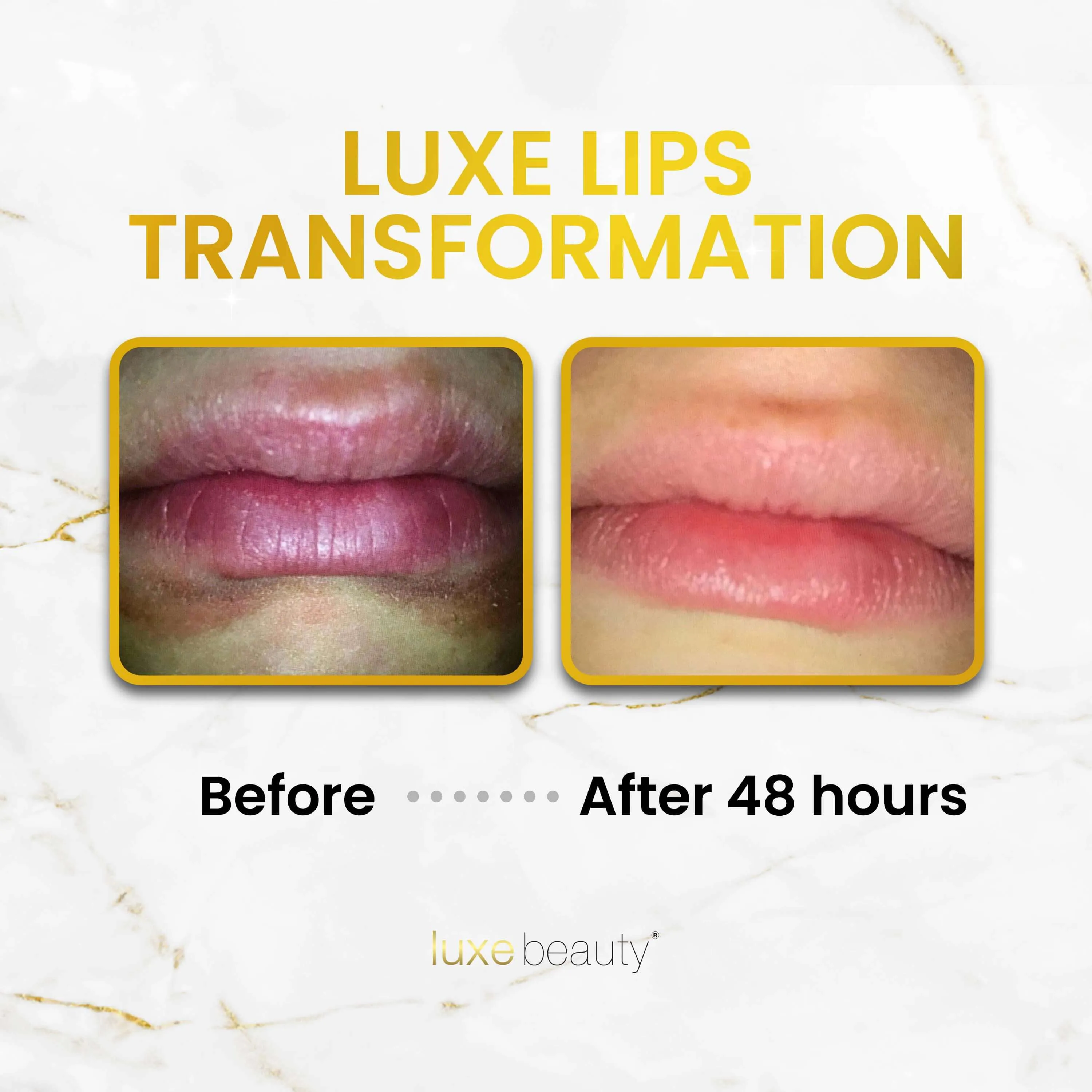 Beeswax Free, Nut Free Lip Balm- Luxe Lips Caramel Popcorn